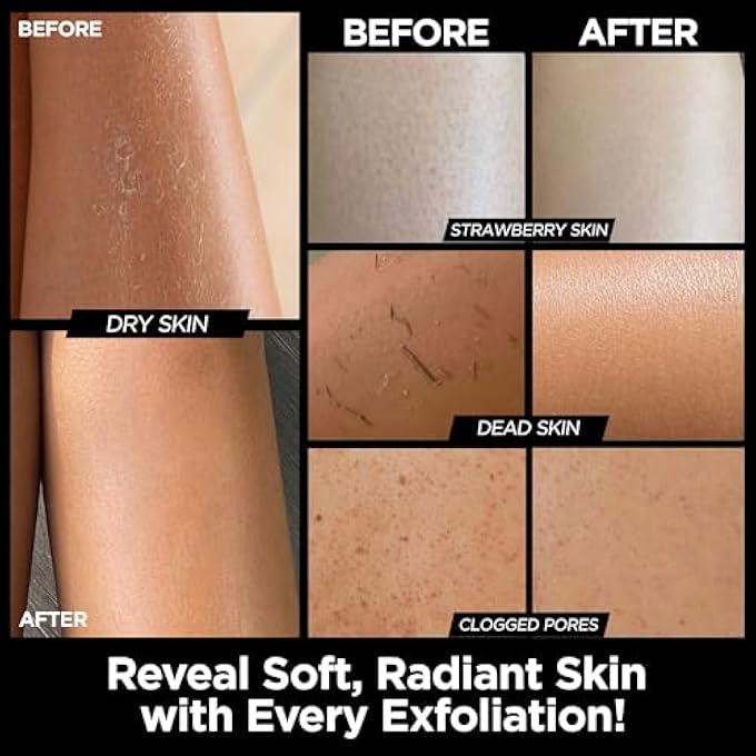 MS Exfoliating Bath Glove for Body Scrub (Kessa mitt) - PACK OF 2 - For Dead Skin Scrubbing and Deep Pore Cleansing - Gentle Viscose Fiber - by MoroccanSource - Image 3